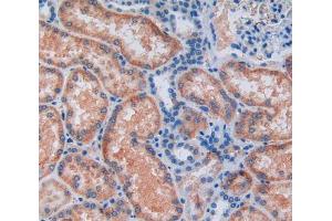 IHC-P analysis of kidney tissue, with DAB staining. (ALDH7A1 antibody  (AA 1-539))