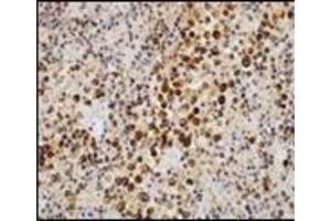 Immunohistochemistry (IHC) image for anti-Epstein-Barr Virus (EBV) (C-Term) antibody (ABIN870471) (EBV antibody  (C-Term))