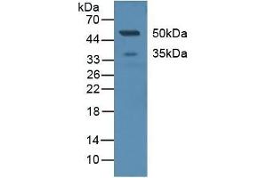 Detection of CD299 in Human Serum using Polyclonal Antibody to Cluster Of differentiation 299 (CD299) (C-Type Lectin Domain Family 4, Member M (CLEC4M) (AA 242-399) antibody)