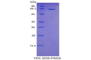 SDS-PAGE (SDS) image for Sulfatase 2 (SULF2) (AA 337-649) protein (His tag,GST tag) (ABIN1525592)