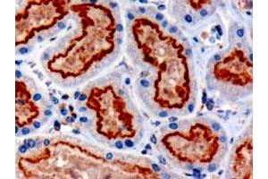 IFT88 polyclonal antibody  (3 ug/mL) staining of paraffin embedded human kidney.