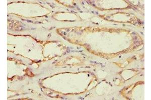 Immunohistochemistry of paraffin-embedded human kidney tissue using ABIN7142945 at dilution of 1:100 (ACAT1 antibody  (AA 1-145))