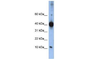 Western Blotting (WB) image for anti-LSM4 Homolog, U6 Small Nuclear RNA Associated (LSM4) antibody (ABIN2458525)