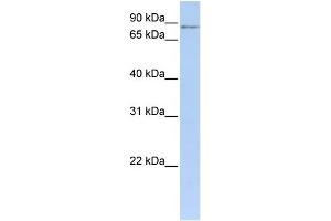 WB Suggested Anti-MTO1 Antibody Titration: 0. (MTO1 antibody  (N-Term))