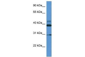 Western Blot showing VASP antibody used at a concentration of 1 ug/ml against Fetal Heart Lysate (VASP antibody  (Middle Region))