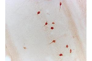 Formalin-fixed and paraffin embedded chicken testis tissue labeled with Anti-Neurturin Polyclonal Antibody, Unconjugated (ABIN724505) 1:200 followed by conjugation to the secondary antibody and DAB staining (Neurturin antibody  (AA 151-197))