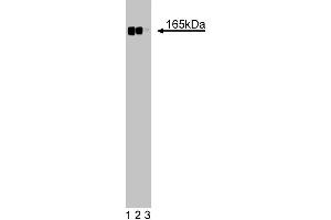 Western blot analysis of Desmoglein on a HeLa cell lysate (Human cervical epitheloid carcinoma, ATCC CCL-2. (Desmoglein (AA 705-1029) antibody)