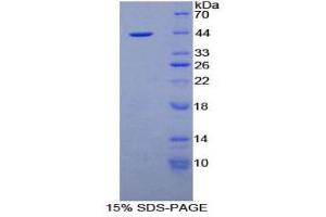 SDS-PAGE (SDS) image for Nesfatin-1 (NES1) (AA 26-106) protein (His tag,GST tag) (ABIN2123354)