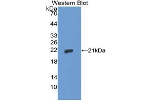 Western blot analysis of the recombinant protein. (Thimet Oligopeptidase 1 antibody  (AA 451-597))