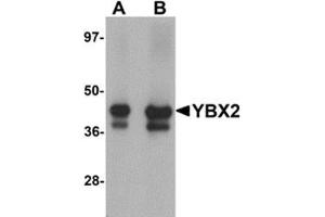 Western blot analysis of YBX2 in human testis tissue lysate with YBX2 antibody at (A) 1 and (B) 2 μg/ml.