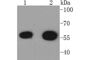 Lane 1: 293T Cell lysates, Lane 2: K562 lysates, probed with HDAC2 (3B7) Monoclonal Antibody  at 1:1000 overnight at 4˚C.