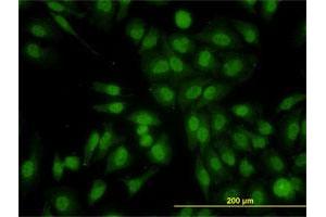 Immunofluorescence of monoclonal antibody to RALGPS2 on HeLa cell. (RALGPS2 antibody  (AA 282-386))