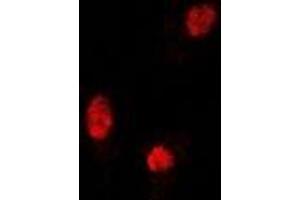 Immunofluorescent analysis of Sox-5 staining in U2OS cells. (SOX5 antibody)