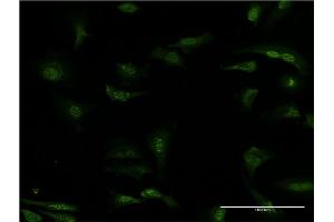 Immunofluorescence of monoclonal antibody to PDE5A on HeLa cell.