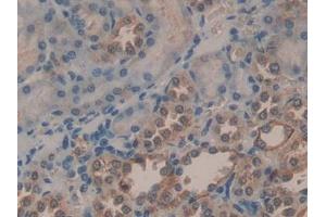 Detection of PGA in Human Kidney Tissue using Polyclonal Antibody to Pepsinogen A (PGA) (Pepsinogen A antibody  (AA 63-295))
