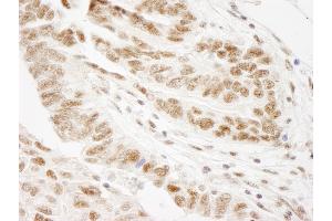 Immunohistochemistry (IHC) image for anti-Wilms Tumor 1 Associated Protein (WTAP) (AA 346-396) antibody (ABIN7449036) (WTAP antibody  (AA 346-396))