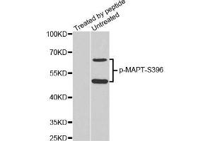 Western Blotting (WB) image for anti-Microtubule-Associated Protein tau (MAPT) (pSer396) antibody (ABIN3019683) (MAPT antibody  (pSer396))