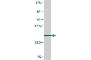 Western Blot detection against Immunogen (37. (TMPRSS2 antibody  (AA 383-492))