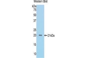 Western blot analysis of the recombinant protein. (ACVR2A antibody  (AA 326-485))