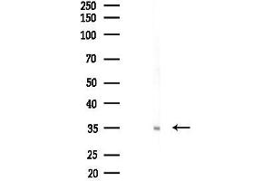 anti-Stanniocalcin 1 (STC1) (C-Term) antibody