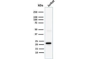 Western Blot Analysis of human Jurkat cell lysate using CD3e Monoclonal Antibody (C3e/1308).