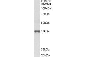 Western Blotting (WB) image for anti-Methionine Adenosyltransferase II, beta (MAT2B) (Isoform 1), (N-Term) antibody (ABIN2465101) (MAT2B antibody  (Isoform 1, N-Term))