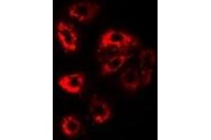 Immunofluorescent analysis of PSMD9 staining in Jurkat cells. (PSMD9 antibody)