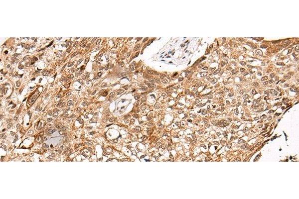 C14orf169 + NO66 antibody