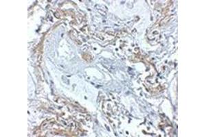 Immunohistochemistry of TNFAIP3 in human lung tissue with this product at 5 μg/ml. (TNFAIP3 antibody  (C-Term))