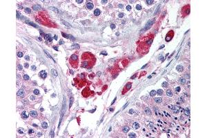 Anti-HIPK3 antibody IHC of human testis. (HIPK3 antibody  (AA 850-900))