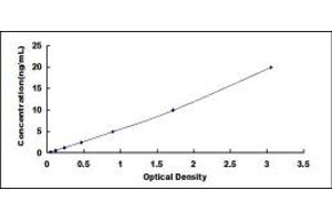 Typical standard curve (CPT1B ELISA Kit)