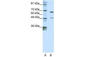 Western Blot showing ZNF597 antibody used at a concentration of 1-2 ug/ml to detect its target protein. (ZNF597 antibody  (N-Term))