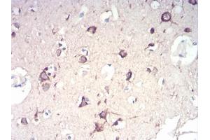 Immunohistochemical analysis of paraffin-embedded brain tissues using NFKBIA mouse mAb with DAB staining.