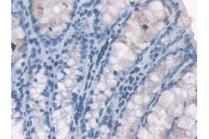 Detection of HBa1 in Mouse Colon Tissue using Polyclonal Antibody to Hemoglobin Alpha 1 (HBa1) (HBA1 antibody  (AA 1-142))
