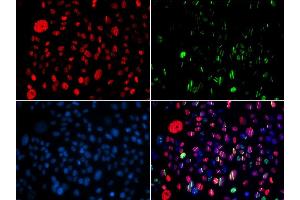 Immunofluorescence (IF) image for anti-Structural Maintenance of Chromosomes 1A (SMC1A) (pSer957) antibody (ABIN3019554)