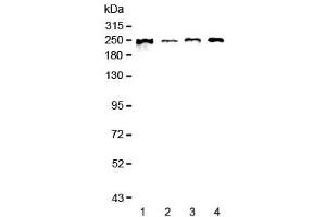 Western blot testing of human 1) MCF7, 2) COLO-320, 3) 22RV1 and 4) SGC-7901 lysate with SCRIB antibody at 0.