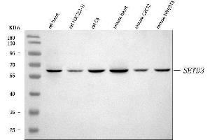 Western blot analysis of SETD3 using anti-SETD3 antibody (ABIN7600293). (SETD3 antibody  (AA 173-468))