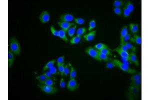 Immunofluorescence staining of HepG2 cells with ABIN7164570 at 1:200, counter-stained with DAPI. (ZDHHC14 antibody  (AA 328-453))