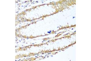 Immunohistochemistry of paraffin-embedded human stomach using MYH9 antibody. (Myosin 9 antibody)