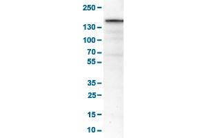Western Blot analysis of RT-4 cell lysates with MKL2 monoclonal antibody, clone CL1546 . (MKL2 antibody  (AA 136-273))
