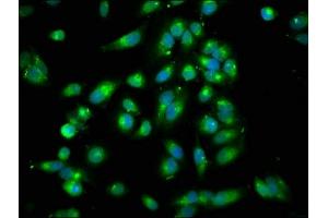 Immunofluorescence staining of Hela cells with ABIN7167994 at 1:250, counter-stained with DAPI. (ARHGEF7 antibody  (AA 1-250))