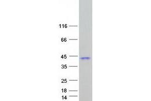 Western Blotting (WB) image for Proenkephalin (PENK) (Transcript Variant 1) protein (Myc-DYKDDDDK Tag) (ABIN2729683)