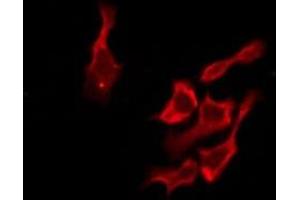 OR51B2 antibody
