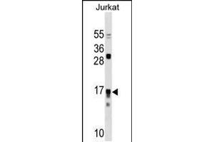 Western blot analysis in Jurkat cell line lysates (35ug/lane). (IL17RC antibody  (N-Term))