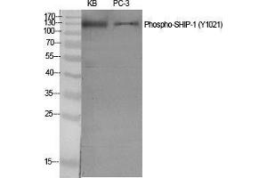 Western Blot (WB) analysis of specific cells using Phospho-SHIP-1 (Y1021) Polyclonal Antibody. (INPP5D antibody  (pTyr1021))