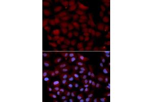 Immunofluorescence analysis of U2OS cell using TNK2 antibody. (TNK2 antibody  (AA 70-385))