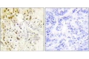 Immunohistochemistry (IHC) image for anti-Cyclin L1 (CCNL1) (AA 461-510) antibody (ABIN2889246) (Cyclin L1 antibody  (AA 461-510))