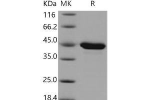 Western Blotting (WB) image for Protein Phosphatase, Mg2+/Mn2+ Dependent, 1A (PPM1A) protein (His tag) (ABIN7320335)