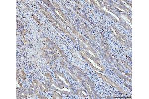 IHC analysis of Grp75 using anti-Grp75 antibody (ABIN7602782). (HSPA9 antibody  (C-Term))