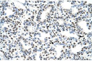 Human Lung; AKAP8L antibody - C-terminal region in Human Lung cells using Immunohistochemistry (AKAP8L antibody  (C-Term))